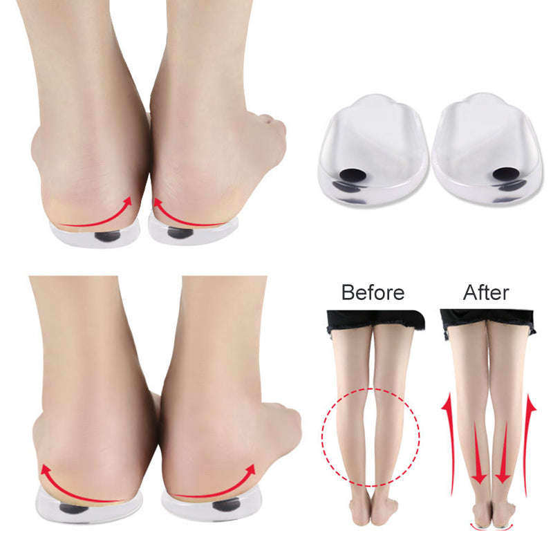 StepAlign™  |  Shoe Insoles Correction Inserts Pads